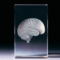 Glasblock - Gehirn anatomisch